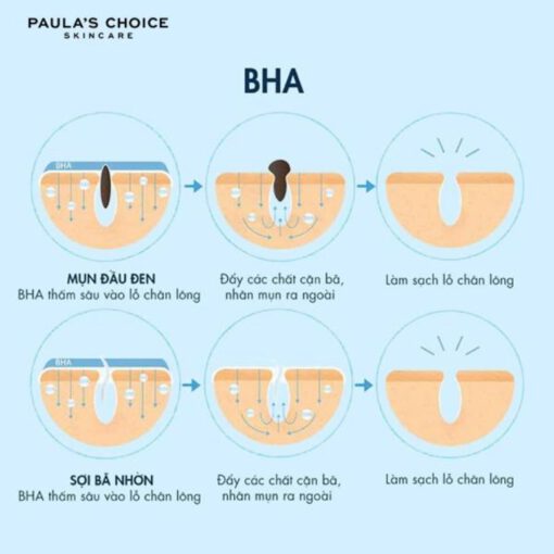 Review BHA Paula's Choice và Cách chọn nồng độ phù hợp nhất